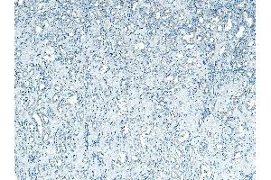 ABIN361184 Negative Control showing staining of paraffin embedded Human Kidney, with no primary antibody.