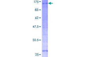 Image no. 1 for Ring Finger Protein 10 (RNF10) (AA 1-811) protein (GST tag) (ABIN1318181)