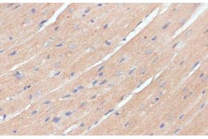 Immunohistochemistry of paraffin-embedded Mouse heart using NHLRC1 Polyclonal Antibody at dilution of 1:100 (40x lens). (NHLRC1 anticorps)