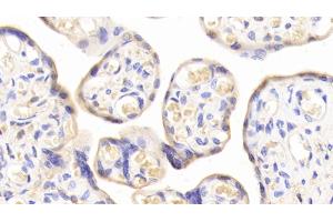 Detection of TFR in Human Placenta Tissue using Polyclonal Antibody to Transferrin Receptor (TFR) (Transferrin Receptor anticorps  (AA 578-765))