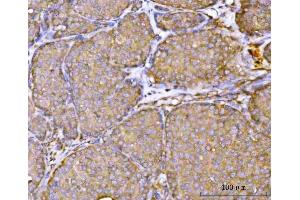 IHC analysis of RPL36 using anti-RPL36 antibody (ABIN7602917). (RPL36 anticorps  (C-Term))