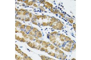 Immunohistochemistry of paraffin-embedded human stomach using HAPLN1 antibody.