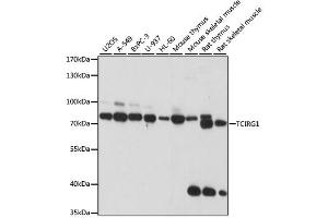 Western blot analysis of extracts of various cell lines, using TCIRG1 antibody. (TCIRG1 anticorps)
