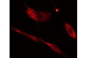 ABIN6274770 staining HeLa cells by IF/ICC. (RPL17 anticorps  (C-Term))