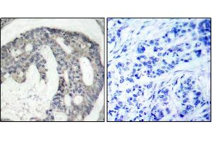 Immunohistochemistry (IHC) image for anti-Nitric Oxide Synthase 3 (Endothelial Cell) (NOS3) (pSer1177) antibody (ABIN1870485) (ENOS anticorps  (pSer1177))