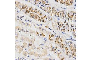 Immunohistochemistry of paraffin-embedded human stomach using BTRC antibody at dilution of 1:200 (x400 lens) (BTRC anticorps  (AA 50-340))