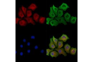 ABIN6264031 and ABIN6278306 staining Hela cells by IF/ICC.