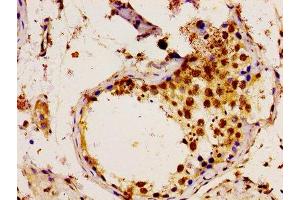 Immunohistochemistry of paraffin-embedded human testis tissue using ABIN7174468 at dilution of 1:100 (UBE2L3 anticorps  (AA 1-154))