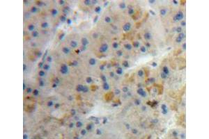 Used in DAB staining on fromalin fixed paraffin-embedded liver tissue (Diazepam Binding Inhibitor anticorps  (AA 1-104))