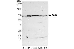 Western Blotting (WB) image for anti-P21-Activated Kinase 4 (PAK4) (AA 25-75) antibody (ABIN7450536)