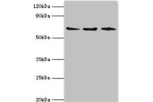 Western blot All lanes: ACAD9 antibody at 6 μg/mL Lane 1: MCF-7 whole cell lysate Lane 2: 293T whole cell lysate Lane 3: K562 whole cell lysate Secondary Goat polyclonal to rabbit IgG at 1/10000 dilution Predicted band size: 69 kDa Observed band size: 69 kDa (ACAD9 anticorps  (AA 1-270))
