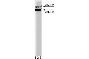 Western blot analysis of Cortactin on a A431 lysate.