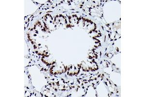 Immunohistochemistry of paraffin-embedded rat lung using Phospho-NRF2-S40 Rabbit mAb (ABIN7268970) at dilution of 1:100 (40x lens).