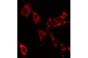 ABIN6275302 staining Hela by IF/ICC. (Neurocan anticorps  (Internal Region))