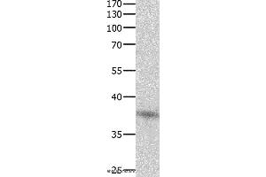 Western blot analysis of Jurkat cell , using DUSP12 Polyclonal Antibody at dilution of 1:500