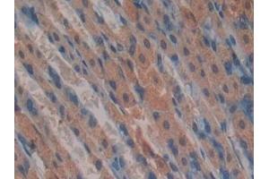 Detection of Grb7 in Mouse Stomach Tissue using Polyclonal Antibody to Growth Factor Receptor Bound Protein 7 (Grb7)