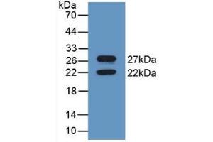 Detection of Recombinant CNX, Mouse using Polyclonal Antibody to Calnexin (CNX) (Calnexin anticorps  (AA 263-482))
