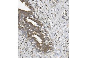IHC analysis of UNG using anti UNG antibody (ABIN7602695).