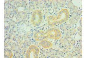 Immunohistochemistry of paraffin-embedded human pancreatic tissue using ABIN7162721 at dilution of 1:100 (PDLIM1 anticorps  (AA 1-329))