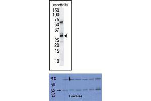 TOP: The anti-DSCR1 Pab is used in Western blot to detect DSCR1 in endothelial tissue lysate. (RCAN1 anticorps  (C-Term))