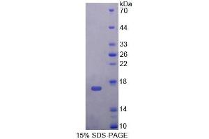 SDS-PAGE analysis of Mouse TNP2 Protein.
