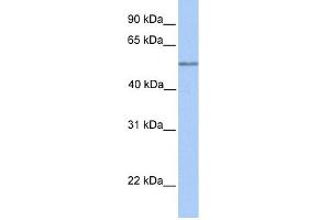 WB Suggested Anti-C17orf74 Antibody Titration: 0. (C17orf74 anticorps  (Middle Region))