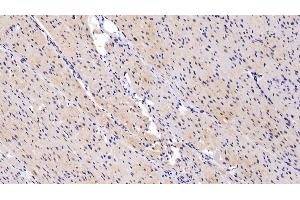 Detection of ANGPTL4 in Porcine Cardiac Muscle Tissue using Polyclonal Antibody to Angiopoietin Like Protein 4 (ANGPTL4)