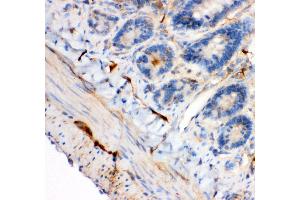 Anti- IRS1 antibody, IHC(P) IHC(P): Rat Intestine Tissue