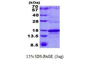 Figure annotation denotes ug of protein loaded and % gel used. (CD247 Protéine)