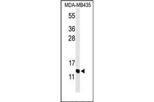 Western blot analysis of GNRH2 Antibody (Center) in MDA-MB435 cell line lysates (35ug/lane).