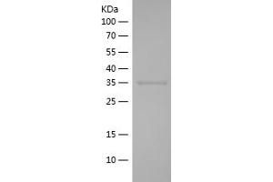 Western Blotting (WB) image for Apurinic/Apyrimidinic Endonuclease 1 (APEX1) (AA 97-195) protein (His-IF2DI Tag) (ABIN7121878)