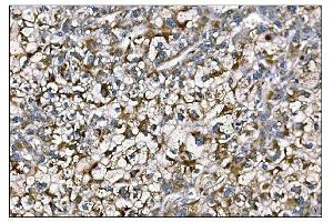 IHC analysis of MERTK using anti-MERTK antibody (ABIN7600623). (MERTK anticorps  (AA 21-489))