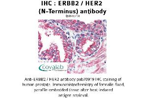 Image no. 1 for anti-Receptor tyrosine-protein kinase erbB-2 (ErbB2/Her2) (Extracellular Domain), (N-Term) antibody (ABIN1734114) (ErbB2/Her2 anticorps  (Extracellular Domain, N-Term))
