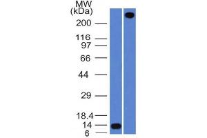 Western Blot Analysis A) Recombinant Protein (B) human lung lysate Using VWF Mouse Monoclonal Antibody (VWF/1465). (VWF anticorps  (AA 1815-1939))