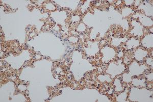 Immunohistochemistry (IHC) image for anti-Natural Killer Cell Receptor 2B4 (CD244) antibody (ABIN5959143) (2B4 anticorps)