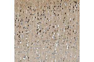 IHC analysis of TORC1/CRTC1 using anti-TORC1/CRTC1 antibody (ABIN7602801). (CRTC1 anticorps  (C-Term))