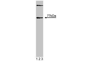 Western blot analysis of Btk on EB1 lysate. (BTK anticorps  (N-Term))