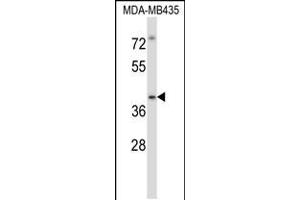 Western blot analysis in MDA-MB435 cell line lysates (35ug/lane).