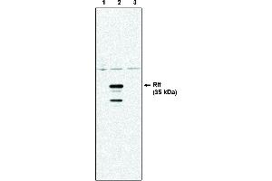 Western blot analysis using Rit antibody . (RIT1 anticorps)