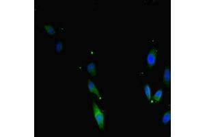 Immunofluorescent analysis of Hela cells using ABIN7171733 at dilution of 1:100 and Alexa Fluor 488-congugated AffiniPure Goat Anti-Rabbit IgG(H+L) (TRF2 anticorps  (AA 78-238))