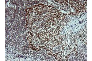 Image no. 4 for anti-Tumor Protein P73 (TP73) (AA 167-409) antibody (ABIN1491005)