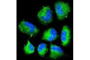 Confocal immunofluorescent analysis of CHAT Antibody (N-term) with NCI-H460 cell followed by Alexa Fluor® 488-conjugated goat anti-rabbit lgG (green). (Choline Acetyltransferase anticorps  (N-Term))