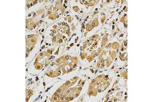 Immunohistochemistry of paraffin-embedded human stomach using PLK1 antibody at dilution of 1:200 (x400 lens) (PLK1 anticorps  (AA 304-603))