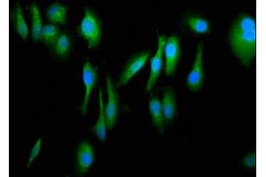 Immunofluorescence staining of Hela cells with ABIN7152698 at 1:266, counter-stained with DAPI.