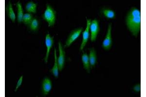 Immunofluorescence staining of Hela cells with ABIN7152698 at 1:266, counter-stained with DAPI. (FERMT1 anticorps  (AA 321-420))