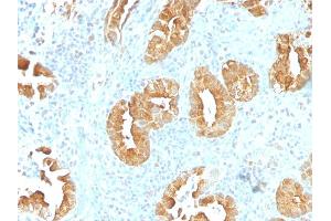 Formalin-fixed, paraffin-embedded human Rectum stained with Villin Monoclonal Antibody (VIL1/1314). (Villin 1 anticorps  (AA 179-311))