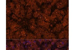 Immunofluorescence analysis of Human liver using HMGCS2 Polyclonal Antibody at dilution of 1:100 (40x lens). (HMGCS2 anticorps)
