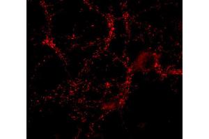 Indirect immunostaining of PFA fixed hippocampus neurons (dilution 1 : 500). (CASKIN1 anticorps)