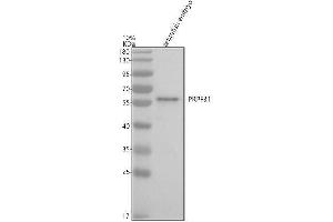Western blot analysis of PRPF31 using anti-PRPF31 antibody (AZQ7SXM7).