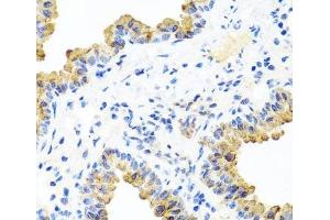 Immunohistochemistry of paraffin-embedded Mouse lung using PIP4K2B Polyclonal Antibody at dilution of 1:100 (40x lens).